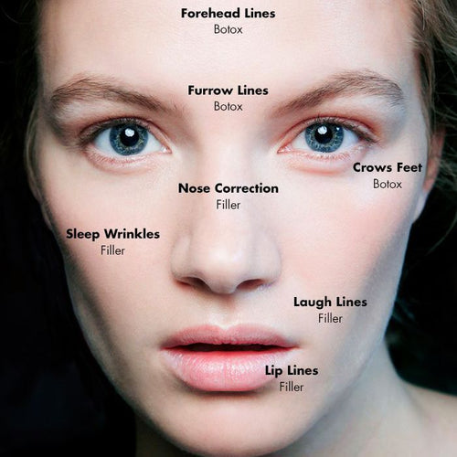 How fillers make you look older and cause you to age faster - O U M E R E