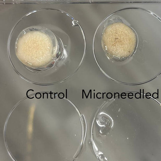 Decayed Skin Microneedling decayed surface of skin in human skin specimens – O U M E R E
