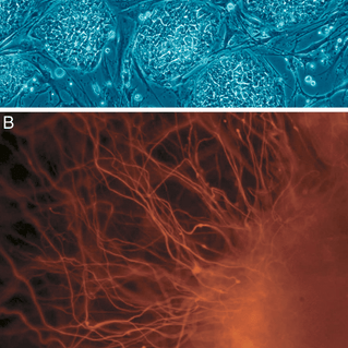 Stem Cells in Skin Care: Fountain of Youth Or Marketing Gimmick? - O U M E R E